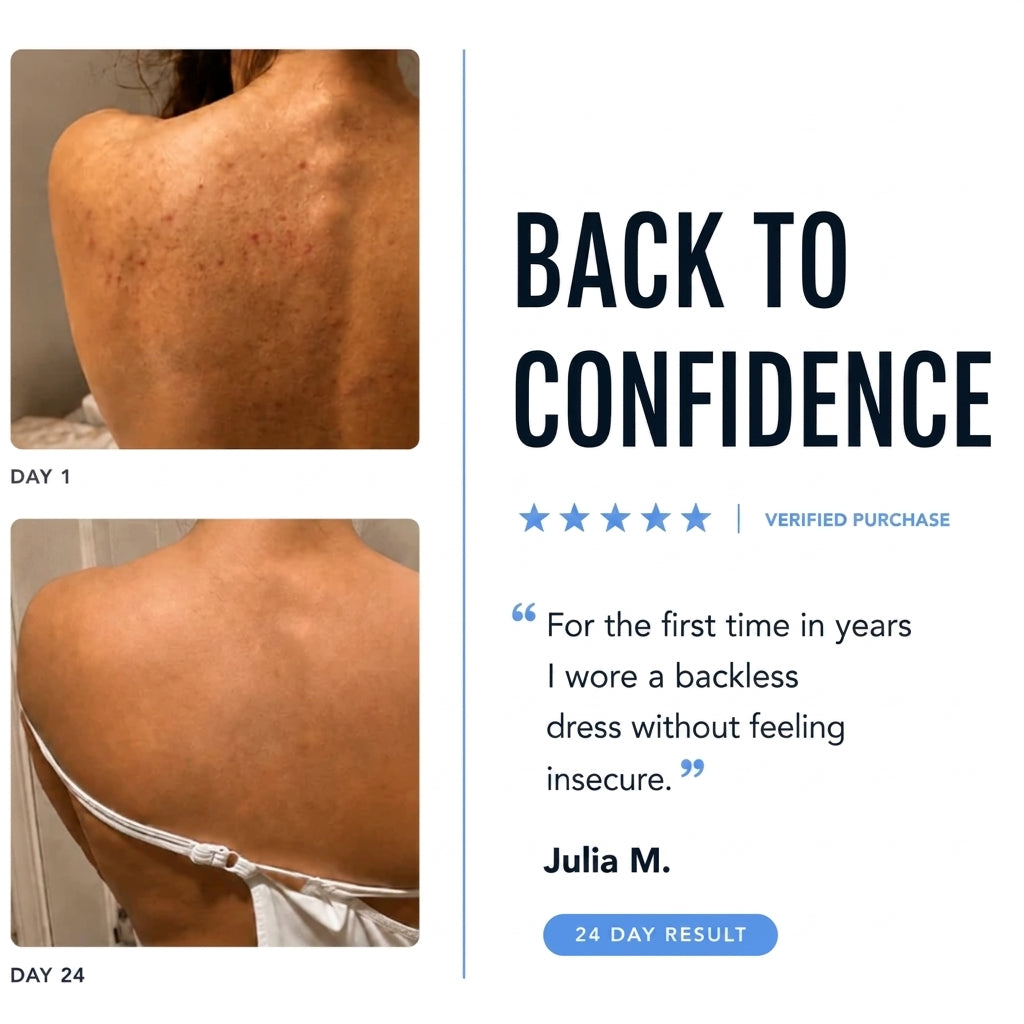 BODY ACNE BAR
