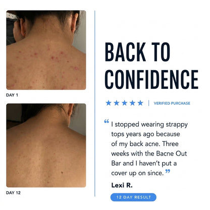 BODY ACNE BAR