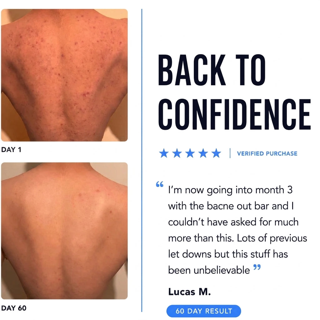 BODY ACNE BAR